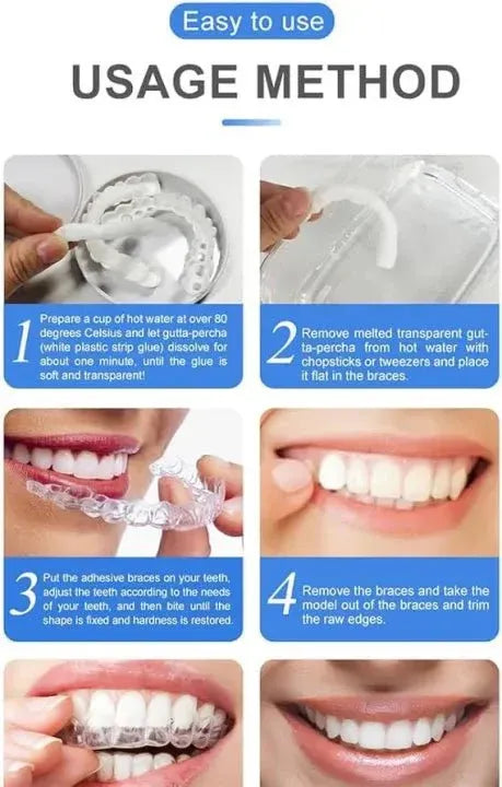 Smile Veneers